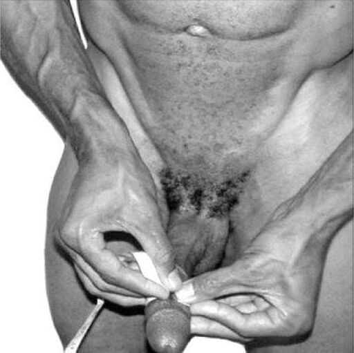 medição do pênis antes do aumento